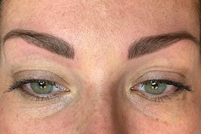 3D Microblading/ Henna Brows Gallery - Patient 11676273 - Image 6