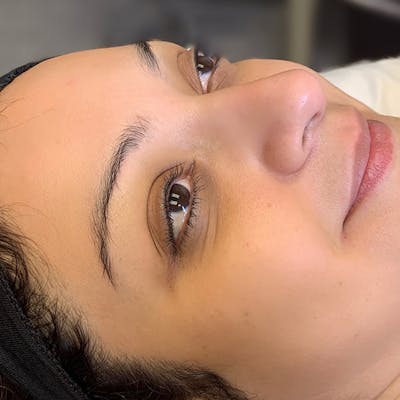3D Microblading/ Henna Brows Before & After Gallery - Patient 94313875 - Image 1