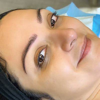 3D Microblading/ Henna Brows Before & After Gallery - Patient 94313875 - Image 2