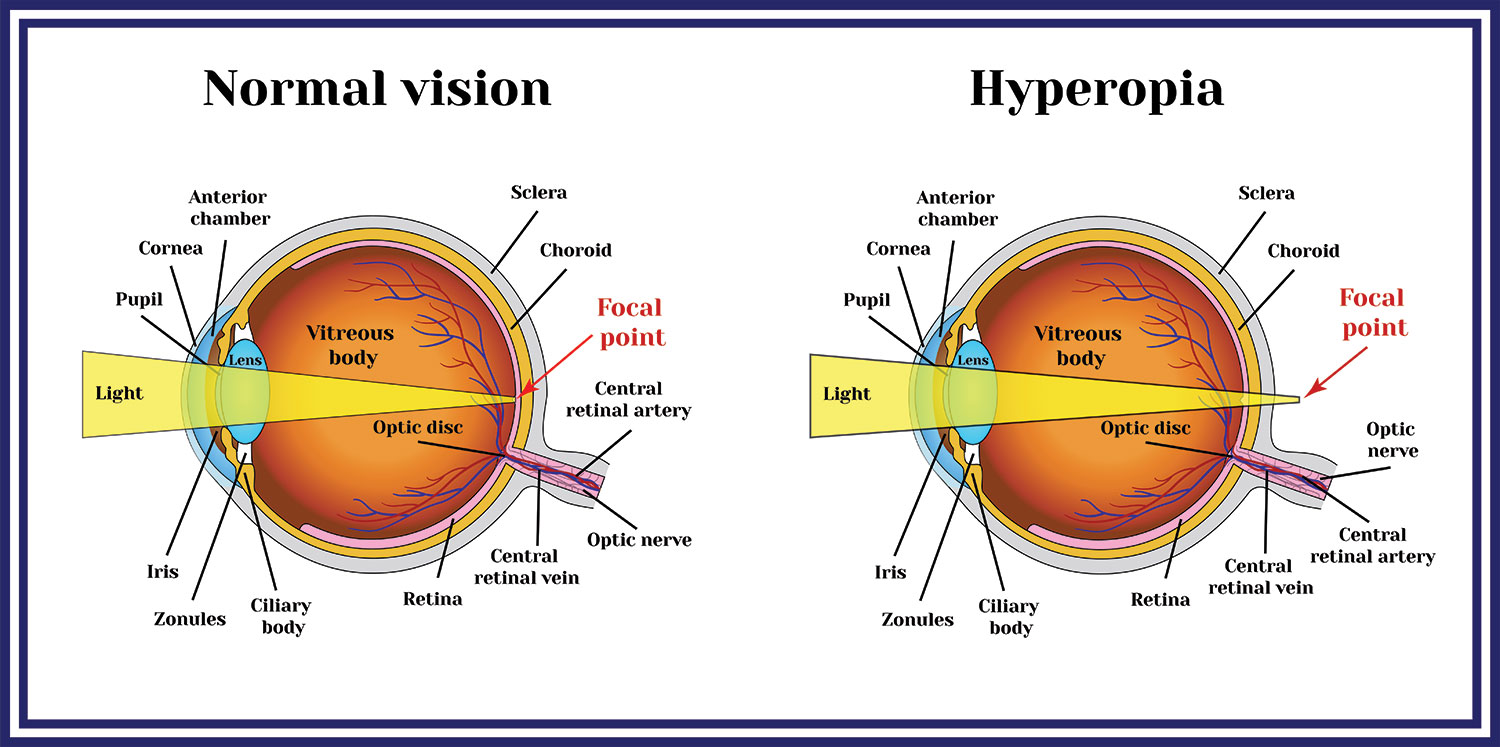 eye diagrams