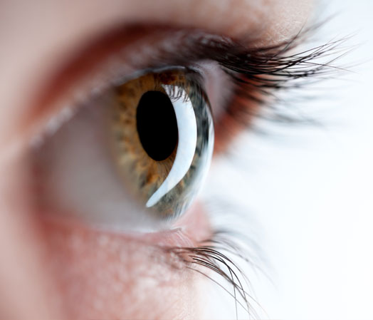 Lasek Vs Lasik, NY