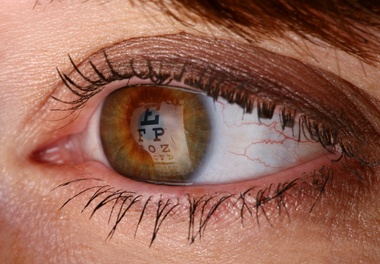 Julia Giyaur, MD | eye care | Brooklyn, NY 