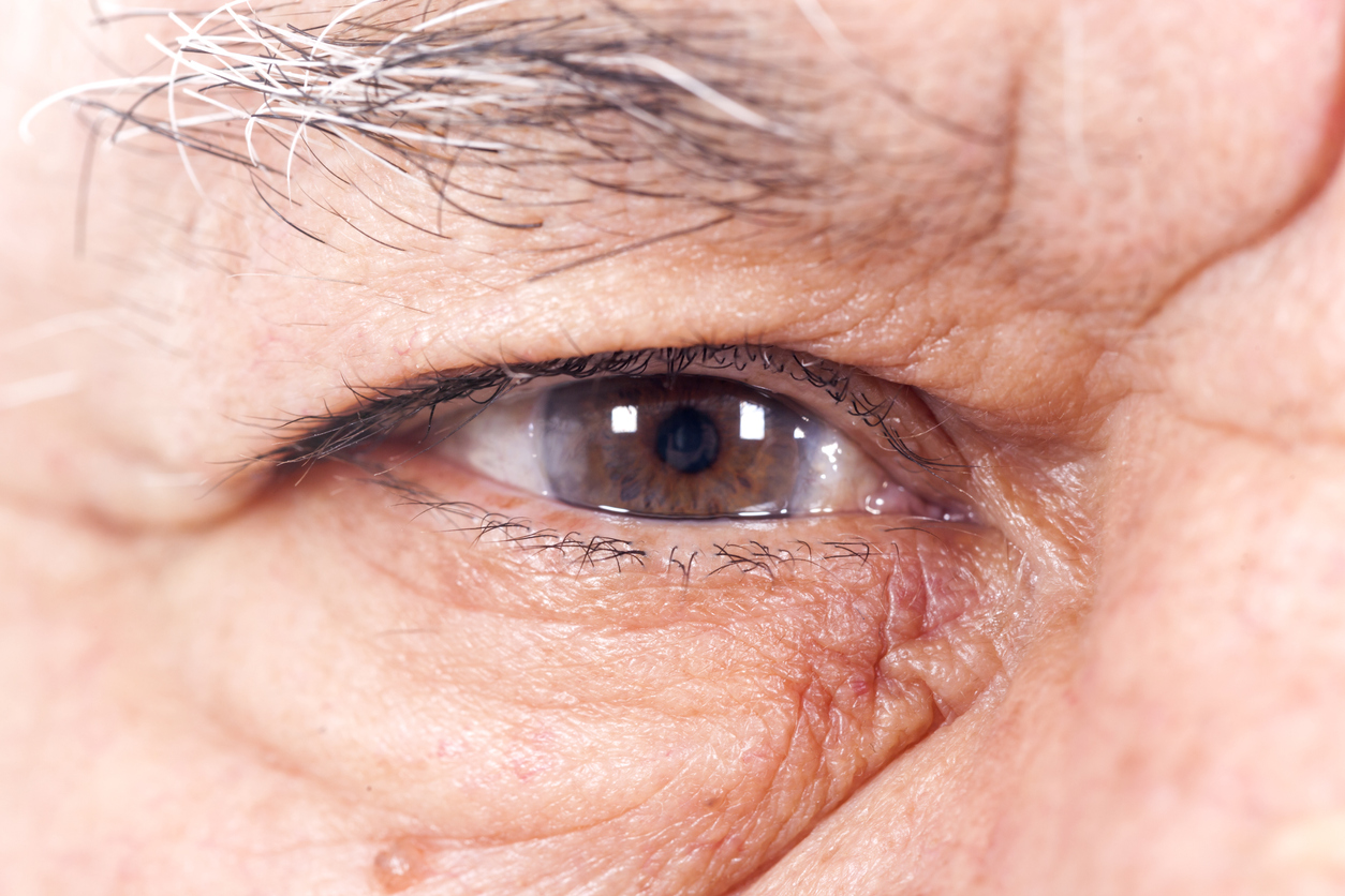 One brown eye of an older male