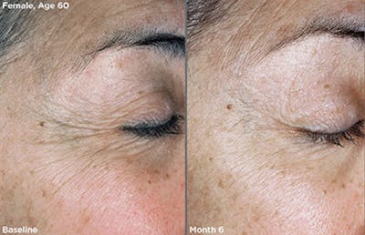 Skin Before & After Gallery - Patient 5750297 - Image 1