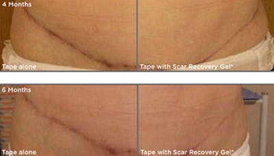 Skin Before & After Gallery - Patient 5750294 - Image 1