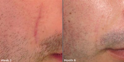Skin Before & After Gallery - Patient 5750293 - Image 1