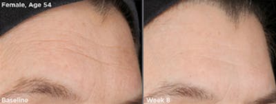 Skin Before & After Gallery - Patient 5750285 - Image 1
