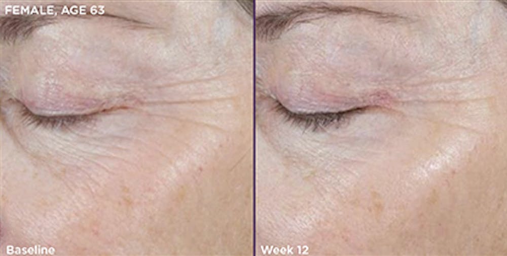 Skin Before & After Gallery - Patient 5750282 - Image 1
