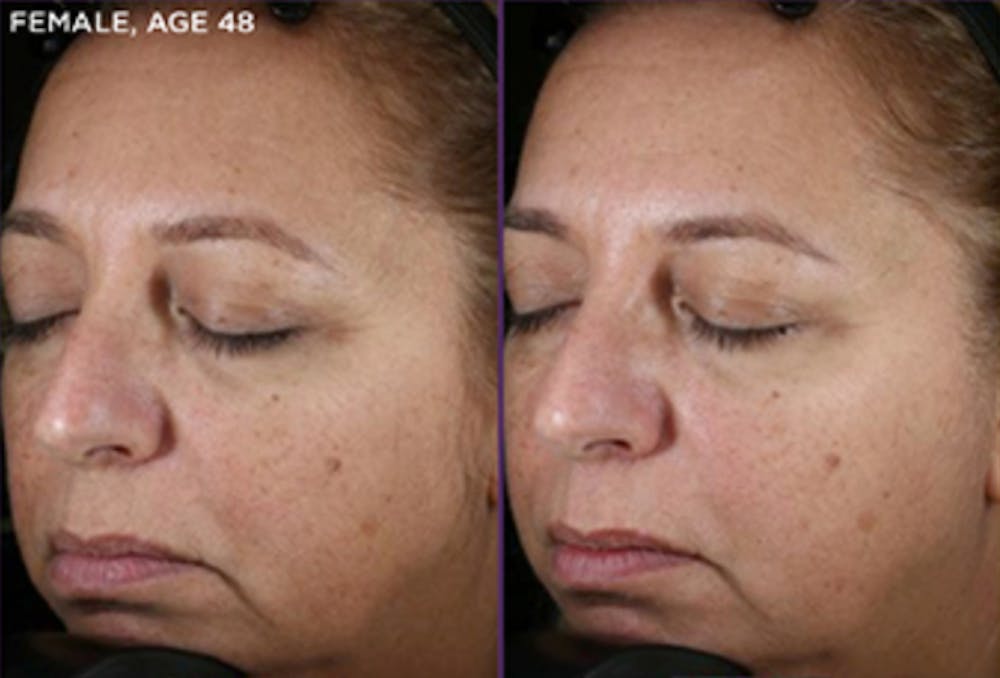 Skin Before & After Gallery - Patient 5750281 - Image 1