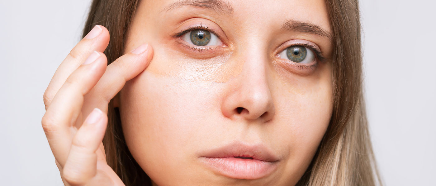 Genesis Lifestyle Medicine Blog | Can Under-Eye Bags and Lines Be Removed Without Surgery? 