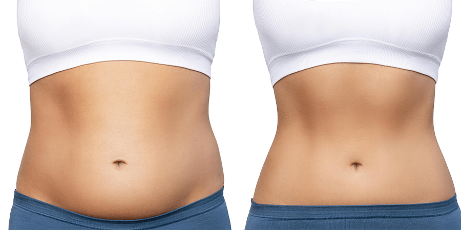 Weight Loss That Actually Works! Semaglutide Is Here! - Complete Wellness, Missouri City, TX