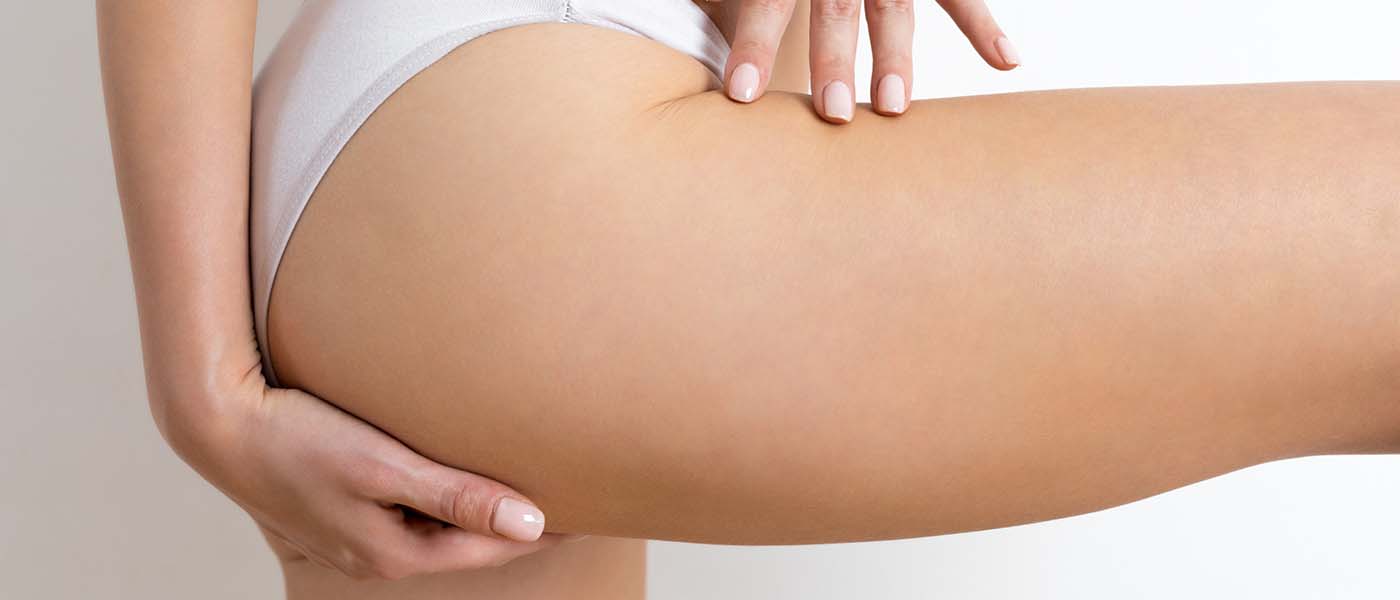 Woman’s leg after successful cellulite reduction treatment at Genesis Lifestyle Medicine.
