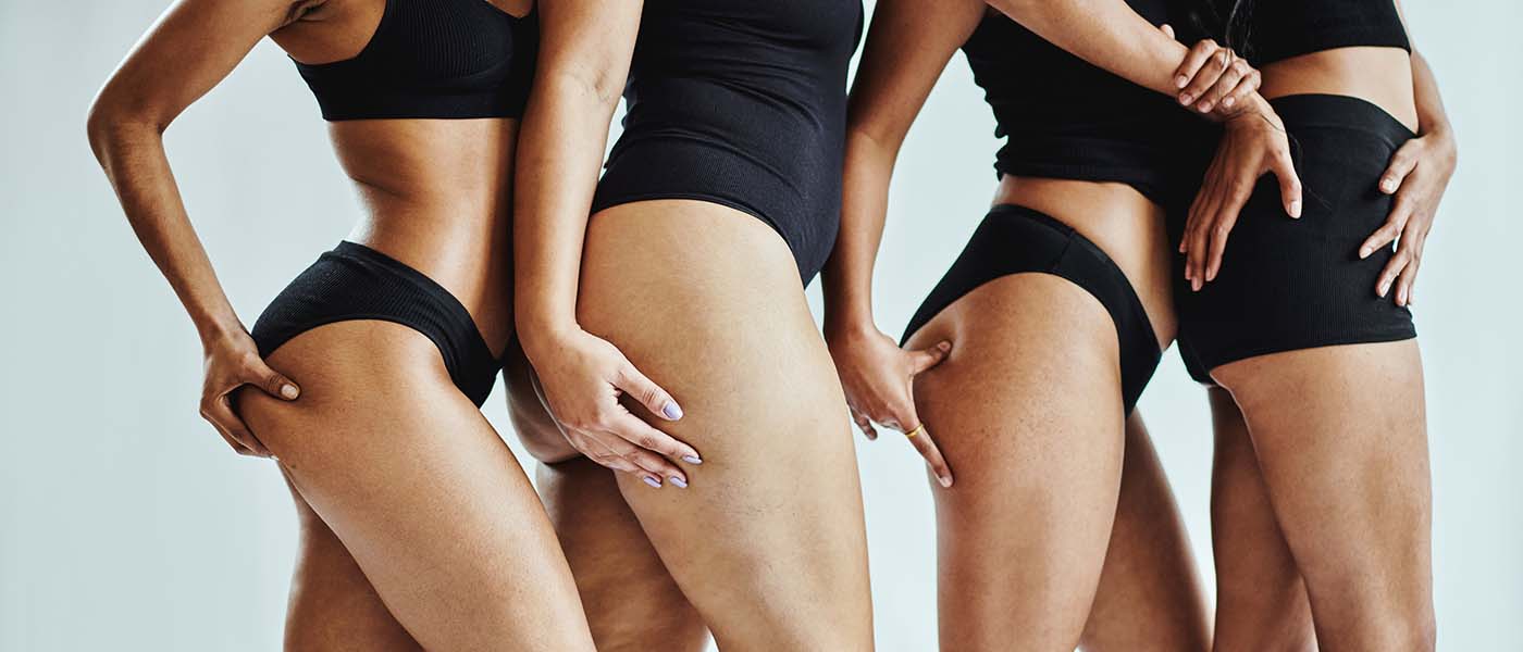 4 women in underwear showing weight loss results from Genesis Lifestyle medicine