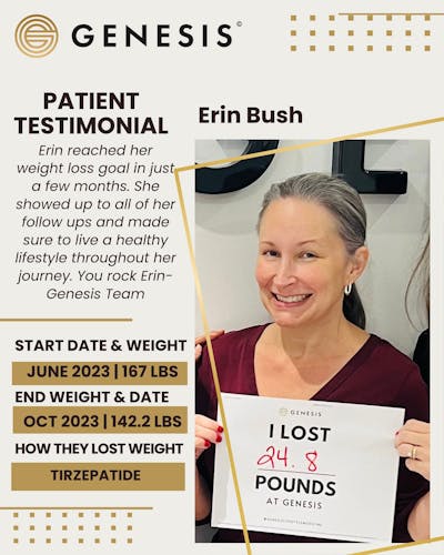 Weight Loss Before & After Gallery - Patient 360286 - Image 1