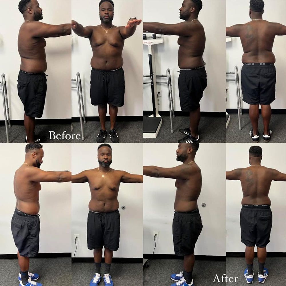 Weight Loss Before & After Gallery - Patient 295405 - Image 2