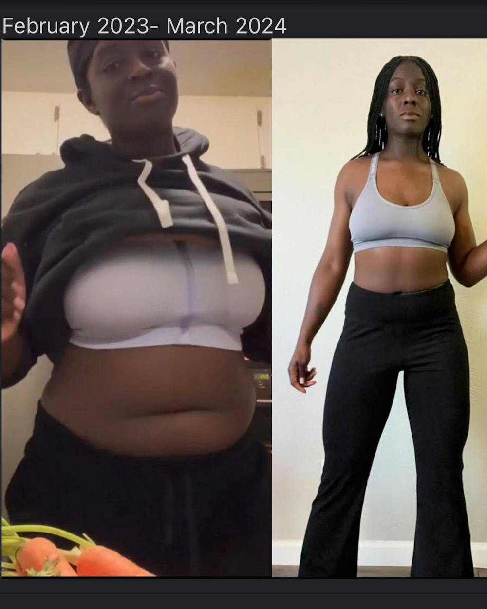Weight Loss Before & After Gallery - Patient 341822 - Image 2