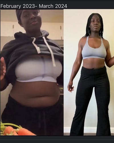 Weight Loss Before & After Gallery - Patient 341822 - Image 2