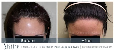 Before & After