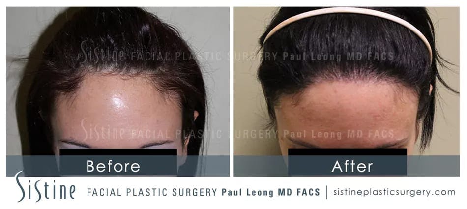 Before & After