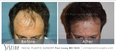Before & After