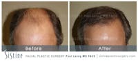 Before & After