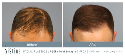 Before & After