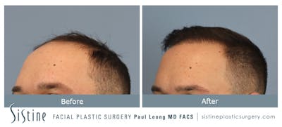 Before & After
