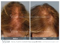 Before & After