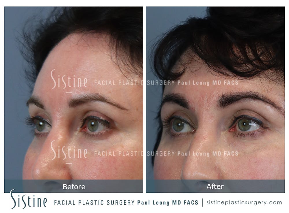 Before & After