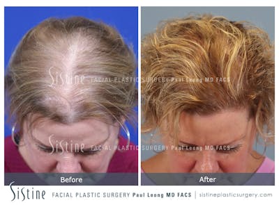 Before & After