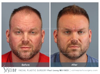 Before & After