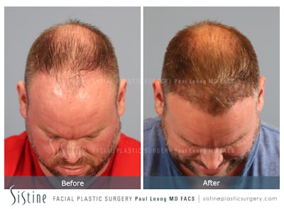 Before & After