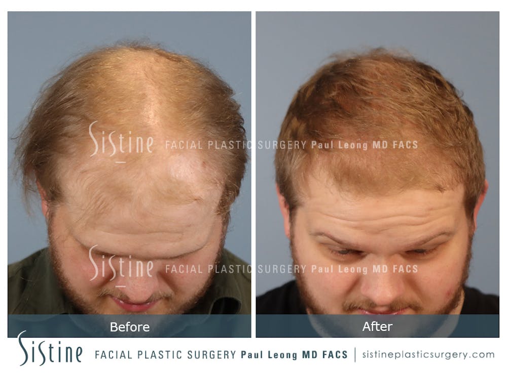 Before & After
