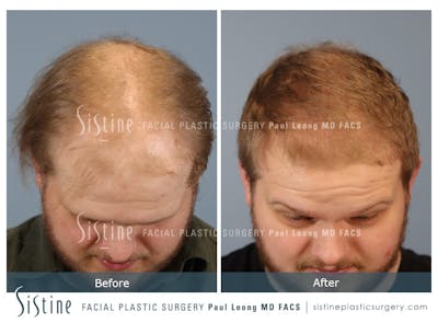 Before & After