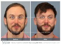 Before & After