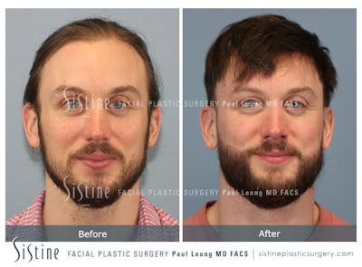 Before & After