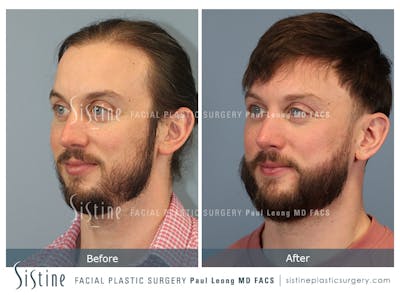 Before & After