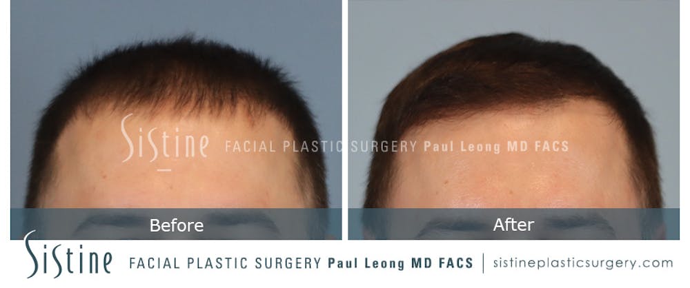 Before & After