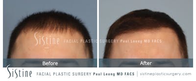 Before & After