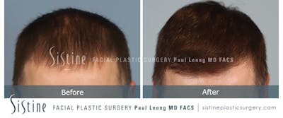 Before & After