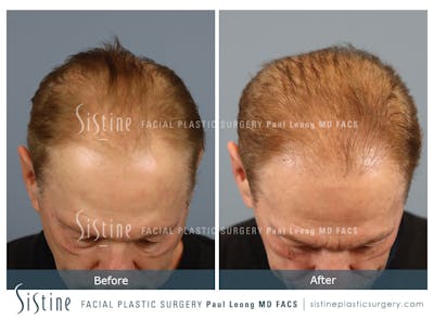 Before & After