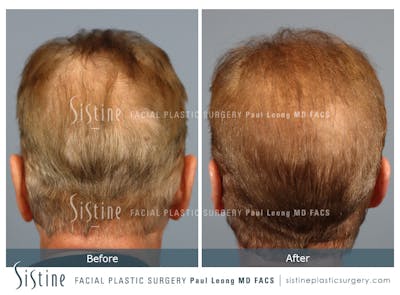 Before & After