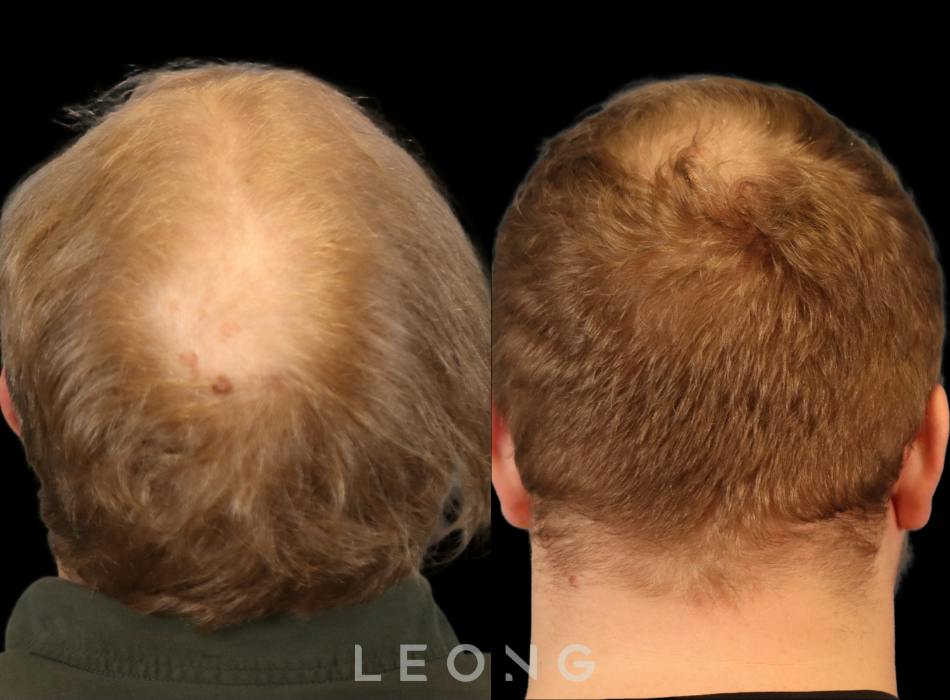 Before & After