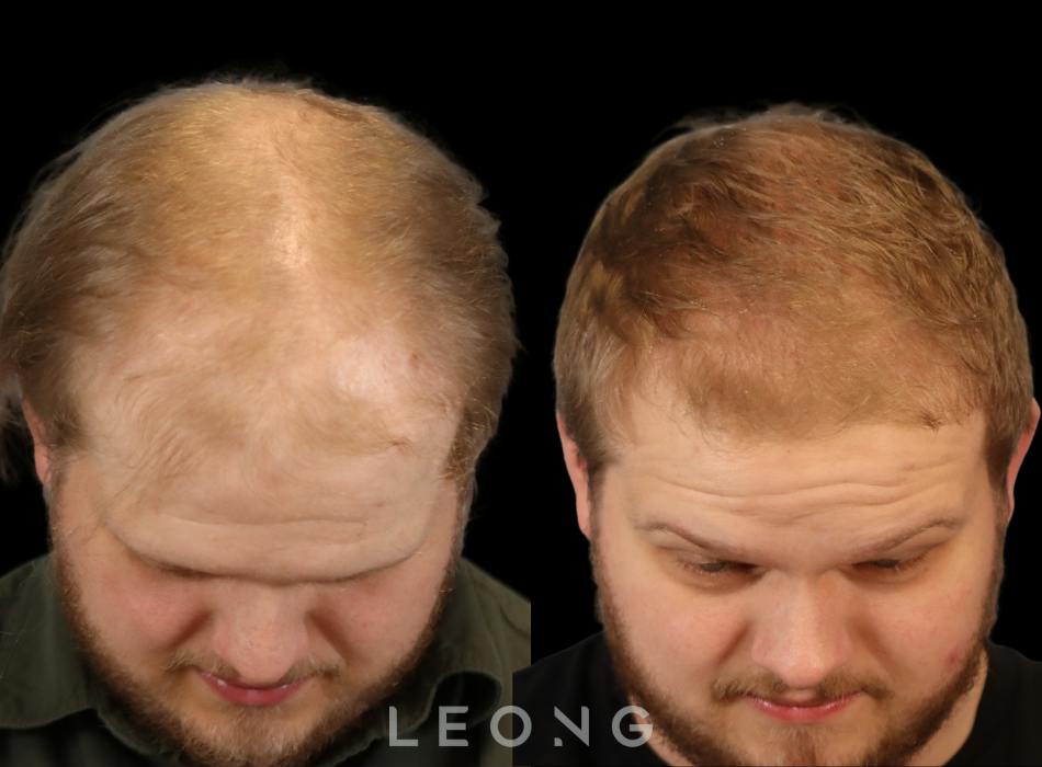 Before & After