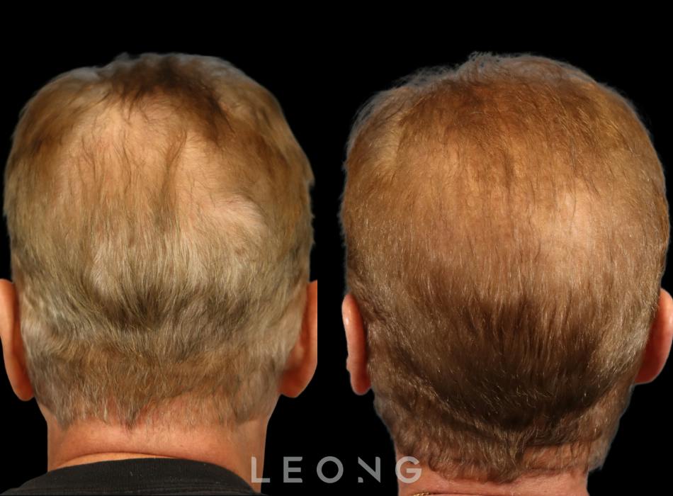 Before & After