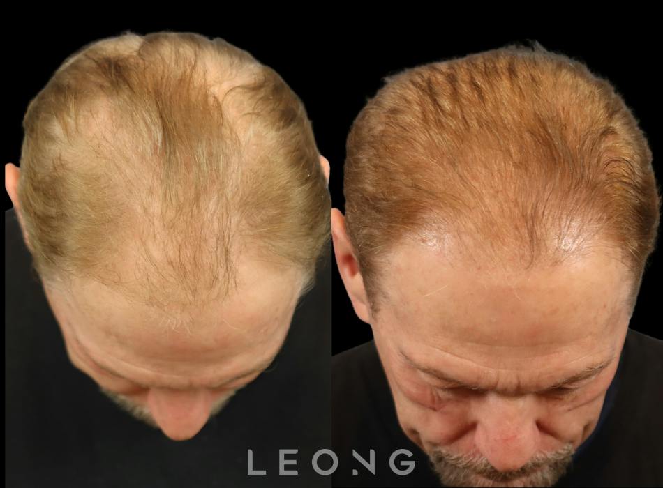 Before & After
