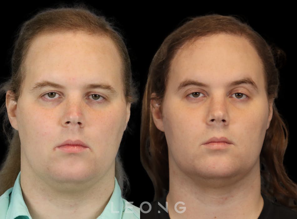 Leong Hair Restoration