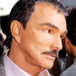 Burt Reynold face-lift