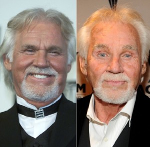Allure Plastic Surgery Blog | Kenny Rogers Plastic Surgery: What Went Wrong