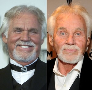 Staten Island Facelift Pro Talks Kenny Rogers Plastic Surgery